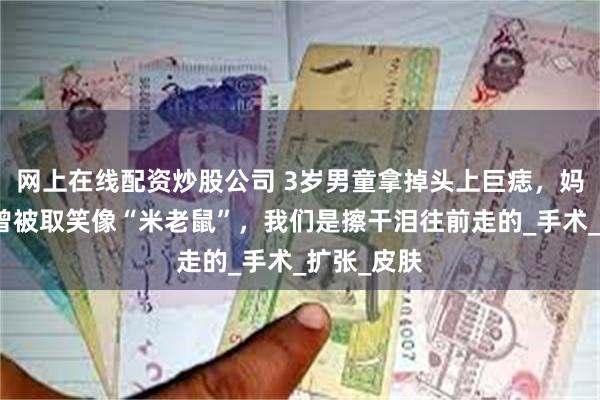 网上在线配资炒股公司 3岁男童拿掉头上巨痣，妈妈：孩子曾被取笑像“米老鼠”，我们是擦干泪往前走的_手术_扩张_皮肤